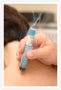 Moxibustion